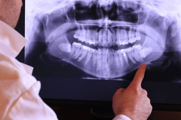 Best Weekend Emergency Dentist in Diablo Grande, CA